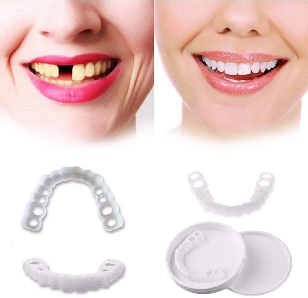Carillas Postiza Dentadura SnapOn Smile