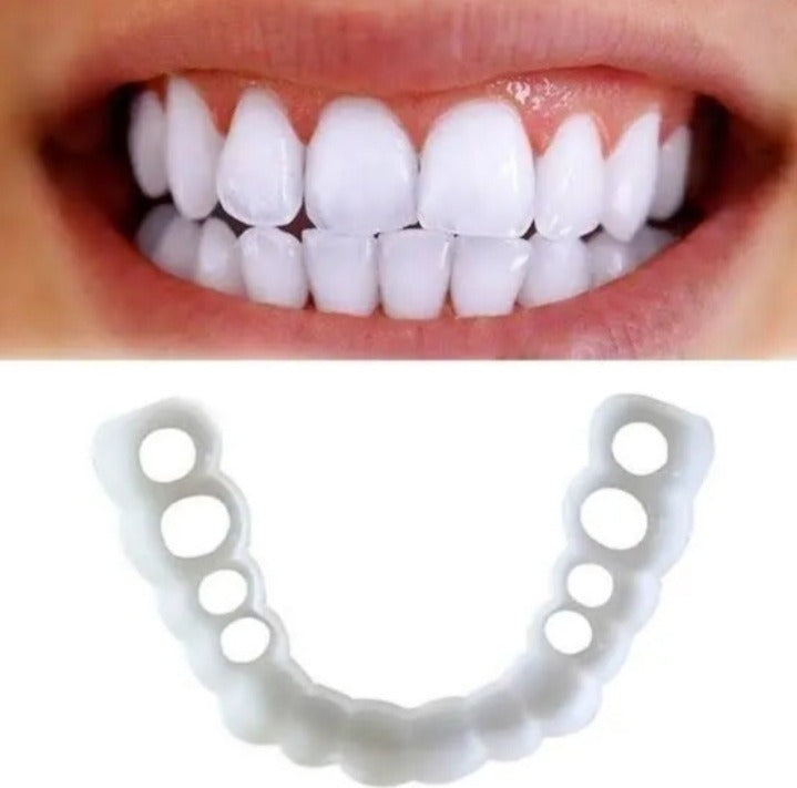 Carillas Postiza Dentadura SnapOn Smile